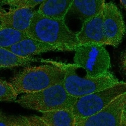 Keratinocyte Differentiation Factor 1 Antibody, Novus Biologicals 100 &mu;L,