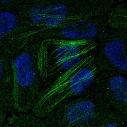 Calponin 2 Antibody, Novus Biologicals 100 &mu;L, Unconjugated:Antibodies,