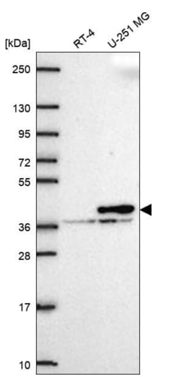 Calponin 2 Antibody, Novus Biologicals 100 &mu;L, Unconjugated:Antibodies,