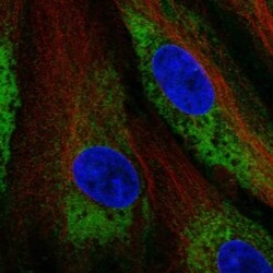 Calumenin Antibody, Novus Biologicals 100 &mu;L, Unconjugated:Antibodies,