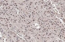 ARID1A Antibody (HL2304) - Azide and BSA Free, Novus Biologicals 100 &mu;L,