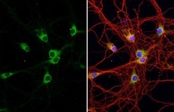 Ataxin-2 Antibody (HL1902) - Azide and BSA Free, Novus Biologicals 100