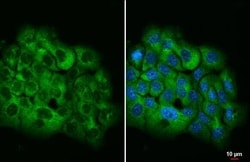 Ataxin-2 Antibody (HL1902) - Azide and BSA Free, Novus Biologicals 100