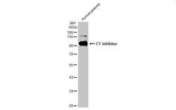Serpin G1/C1 Inhibitor Antibody (HL1196) - Azide and BSA Free, Novus Biologicals