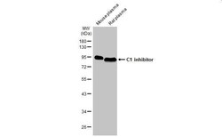 Serpin G1/C1 Inhibitor Antibody (HL1196) - Azide and BSA Free, Novus Biologicals