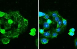 Serpin G1/C1 Inhibitor Antibody (HL1196) - Azide and BSA Free, Novus Biologicals
