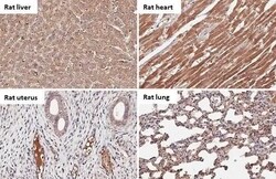 Serpin G1/C1 Inhibitor Antibody (HL1196) - Azide and BSA Free, Novus Biologicals