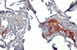 Serpin G1/C1 Inhibitor Antibody (HL1196) - Azide and BSA Free, Novus Biologicals