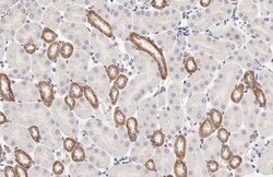 Calcium-sensing R/CaSR Antibody (HL2357) - Azide and BSA Free, Novus Biologicals