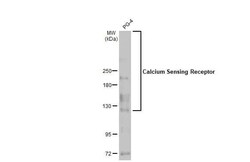 Calcium-sensing R/CaSR Antibody (HL2357) - Azide and BSA Free, Novus Biologicals