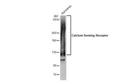 Calcium-sensing R/CaSR Antibody (HL2357) - Azide and BSA Free, Novus Biologicals