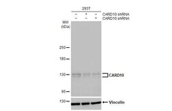 CARD10 Antibody (HL2260) - Azide and BSA Free, Novus Biologicals 100 &mu;L,