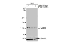 CARD10 Antibody (HL2261) - Azide and BSA Free, Novus Biologicals 100 &mu;L,