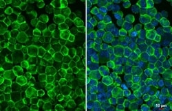Fc gamma RIIB/CD32b Antibody (HL1948) - Azide and BSA Free, Novus Biologicals