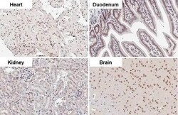 CHD2 Antibody (HL2066) - Azide and BSA Free, Novus Biologicals 100 &mu;L,
