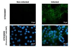 Chikungunya Virus nsp2 Antibody (HL1431) - Azide and BSA Free, Novus Biologicals