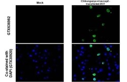 Chikungunya Virus nsp2 Antibody (HL1488) - Azide and BSA Free, Novus Biologicals