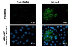 Chikungunya Virus nsp2 Antibody (HL1488) - Azide and BSA Free, Novus Biologicals