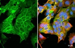 Claudin-3 Antibody (HL1528) - Azide and BSA Free, Novus Biologicals 100