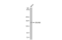 COL1A2 Antibody (HL2048) - Azide and BSA Free, Novus Biologicals 100 &mu;L,
