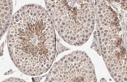 Collagen I/II/III Antibody (HL2048 + HL1907) - Azide and BSA Free, Novus Biologicals 100 &mu;L | Buy Online | Novus Biologicals | Fisher Scientific