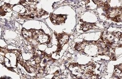 Collagen I/II/III Antibody (HL2048 + HL1907) - Azide and BSA Free, Novus Biologicals 100 &mu;L | Buy Online | Novus Biologicals | Fisher Scientific