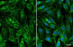 Cyr61/CCN1 Antibody (HL2144) - Azide and BSA Free, Novus Biologicals 100