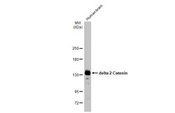 delta 2 Catenin Antibody (HL1629) - Azide and BSA Free, Novus Biologicals