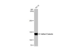 delta 2 Catenin Antibody (HL1629) - Azide and BSA Free, Novus Biologicals