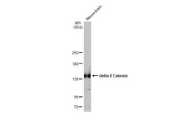 delta 2 Catenin Antibody (HL1629) - Azide and BSA Free, Novus Biologicals