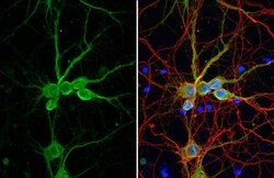 delta 2 Catenin Antibody (HL1629) - Azide and BSA Free, Novus Biologicals
