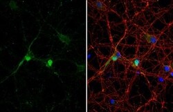 DLX2 Antibody (HL1942) - Azide and BSA Free, Novus Biologicals 100 &mu;L,