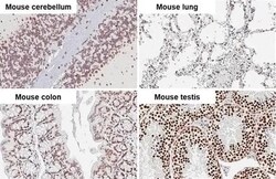DNA Ligase III Antibody (HL2280) - Azide and BSA Free, Novus Biologicals