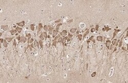 Dopamine D2R/DRD2 Antibody (HL1584) - Azide and BSA Free, Novus Biologicals