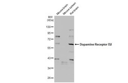 Dopamine D2R/DRD2 Antibody (HL1584) - Azide and BSA Free, Novus Biologicals