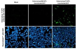 Enterovirus 71 VP1 Antibody (HL1928) - Azide and BSA Free, Novus Biologicals