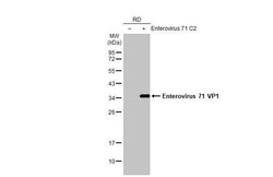 Enterovirus 71 VP1 Antibody (HL1928) - Azide and BSA Free, Novus Biologicals