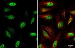 ETS2 Antibody (HL2259) - Azide and BSA Free, Novus Biologicals 100 &mu;L,
