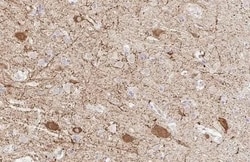 GAD1/GAD67 Antibody (HL1095) - Azide and BSA Free, Novus Biologicals 100