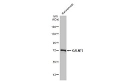GALNT6 Antibody (HL2392) - Azide and BSA Free, Novus Biologicals 100 &mu;L | Buy Online | Novus Biologicals | Fisher Scientific