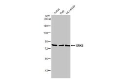 GRK2 Antibody (HL1562) - Azide and BSA Free, Novus Biologicals 100 &mu;L,