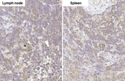 GRK2 Antibody (HL1562) - Azide and BSA Free, Novus Biologicals 100 &mu;L,