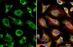 GRK2 Antibody (HL1562) - Azide and BSA Free, Novus Biologicals 100 &mu;L,