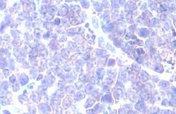 GRK2 Antibody (HL1562) - Azide and BSA Free, Novus Biologicals 100 &mu;L,