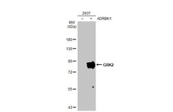 GRK2 Antibody (HL1562) - Azide and BSA Free, Novus Biologicals 100 &mu;L,