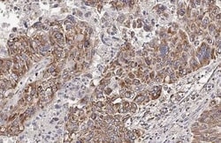 Hck Antibody (HL1673) - Azide and BSA Free, Novus Biologicals 100 &mu;L,