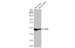 Hck Antibody (HL1673) - Azide and BSA Free, Novus Biologicals 100 &mu;L,