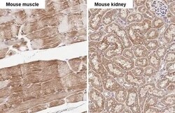 SDHB Antibody (HL2251) - Azide and BSA Free, Novus Biologicals 100 &mu;L | Buy Online | Novus Biologicals | Fisher Scientific