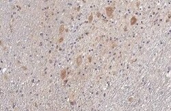 SDHB Antibody (HL2251) - Azide and BSA Free, Novus Biologicals 100 &mu;L | Buy Online | Novus Biologicals | Fisher Scientific