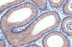 Hip Antibody (HL1737) - Azide and BSA Free, Novus Biologicals 100 &mu;L,